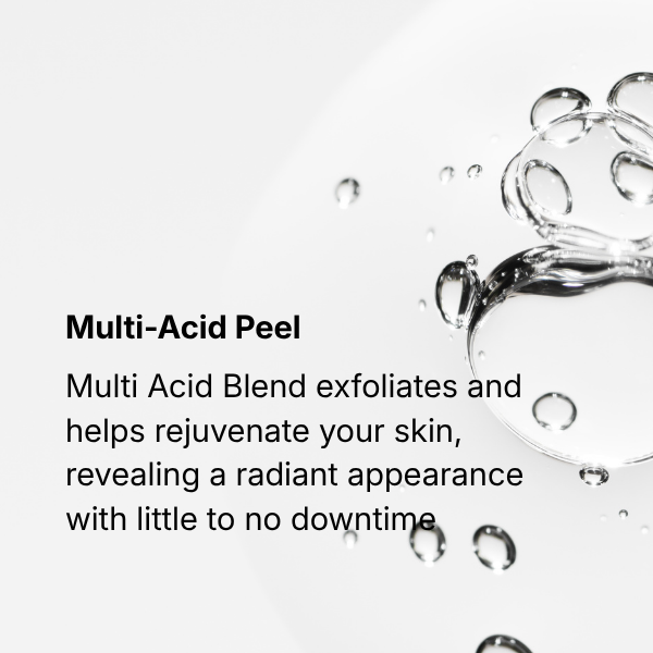 STEP ONE: PEEL